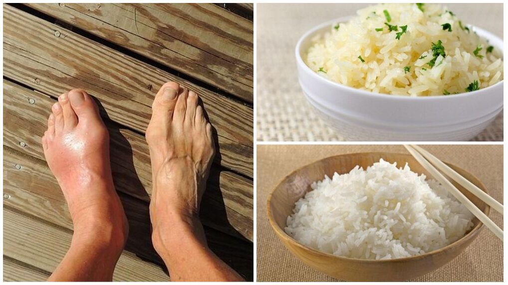 Dla pacjentów z dną moczanową zalecana jest dieta oparta na ryżu. 